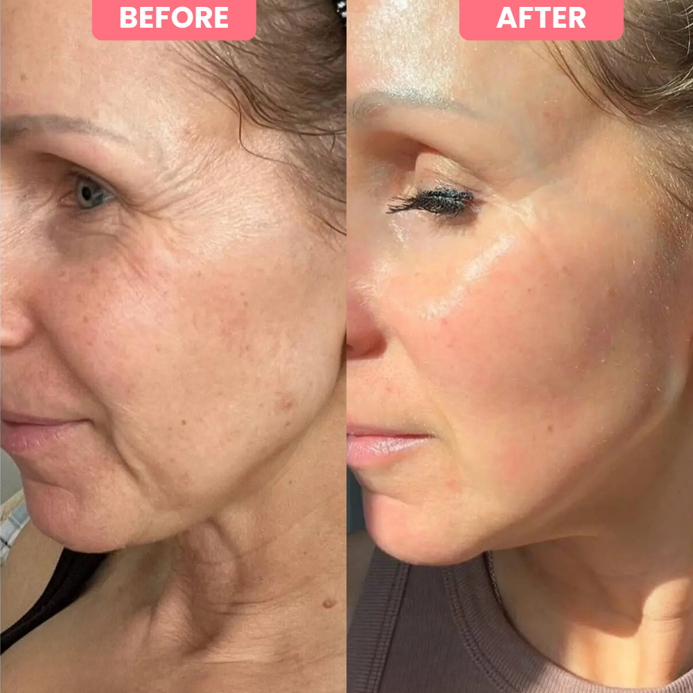 Bio-Collagen Mask