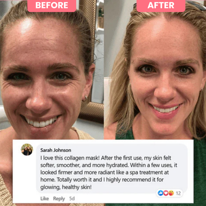 Bio-Collagen Mask