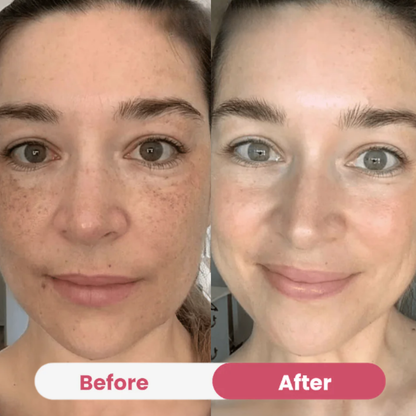 Bio-Collagen Mask
